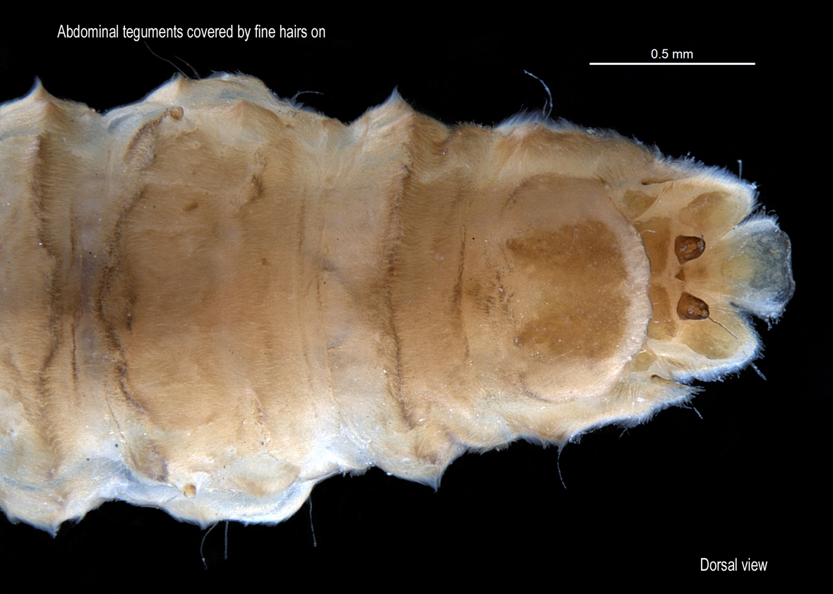 Abdomen in dorsal view