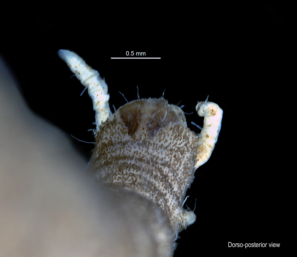 Abdomen in dorso posterior view