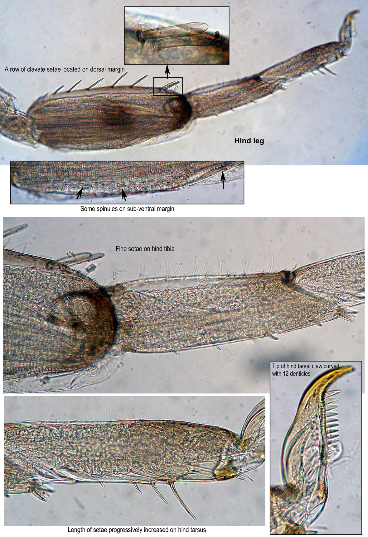 Hindleg