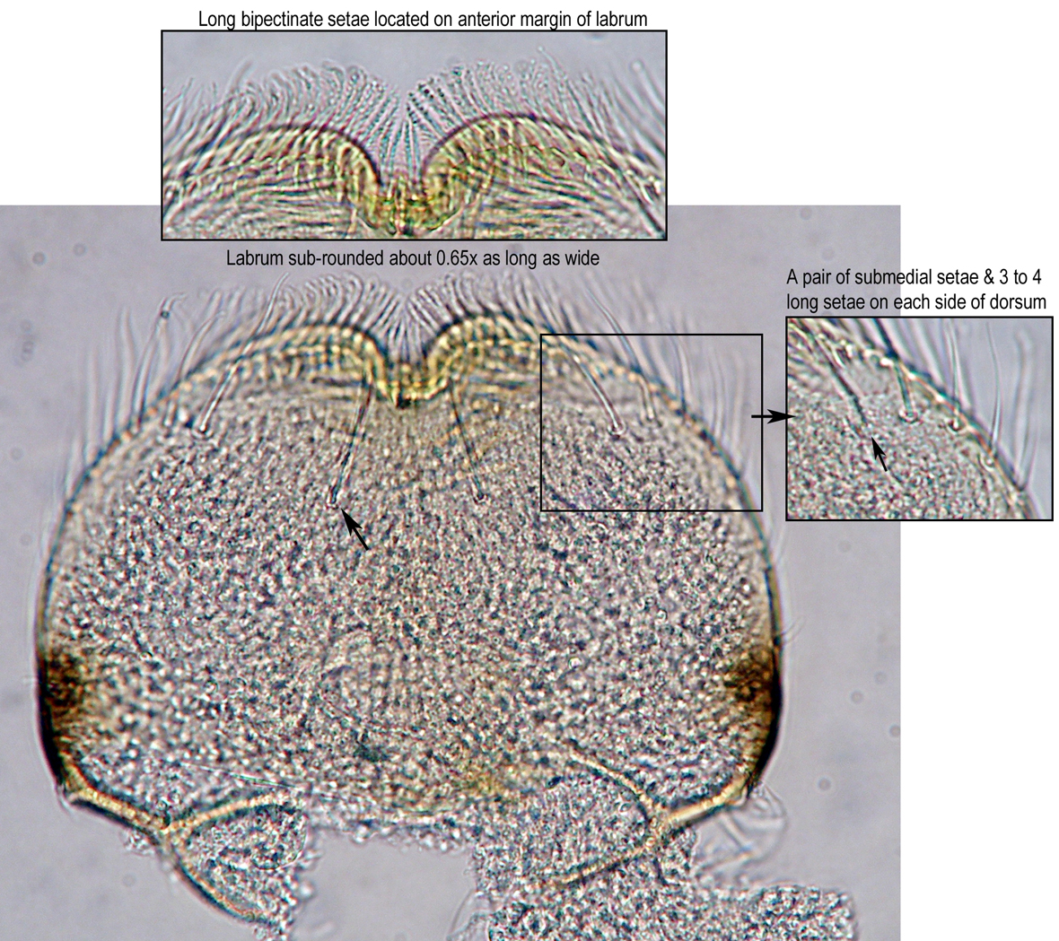 labrum