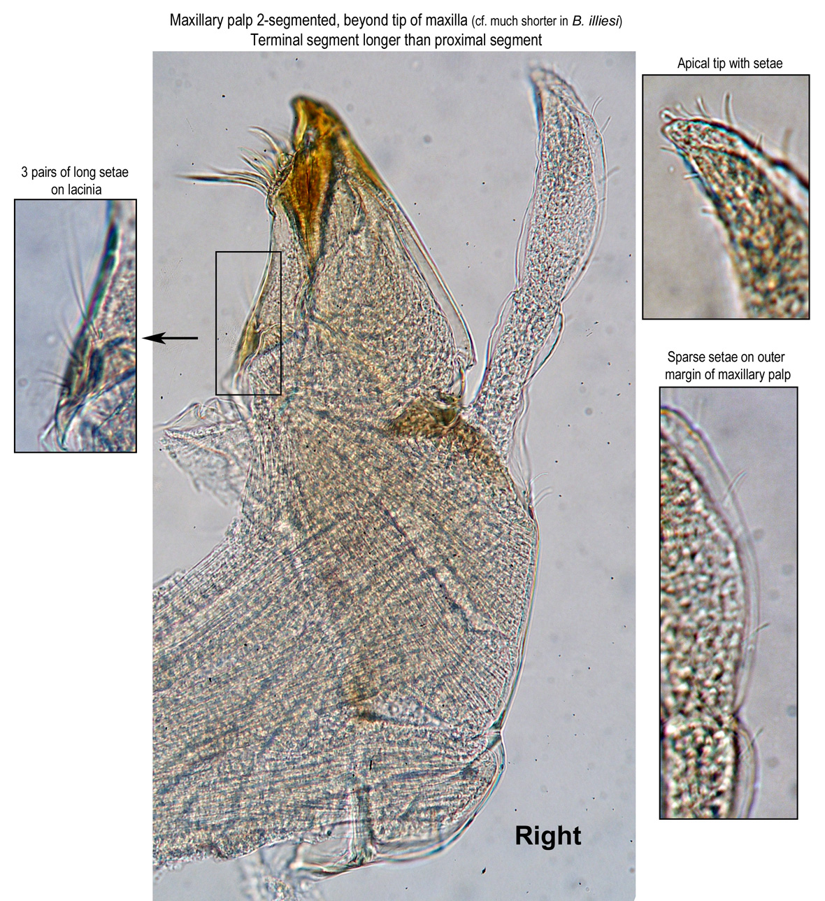 Right maxilla