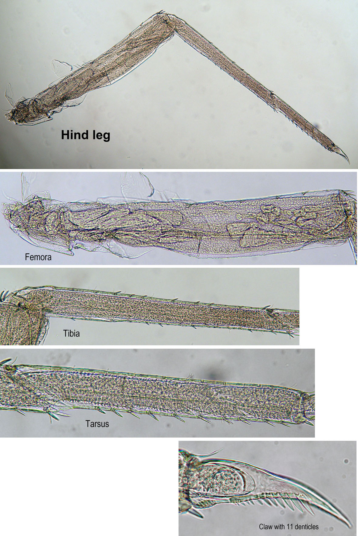 Hind leg