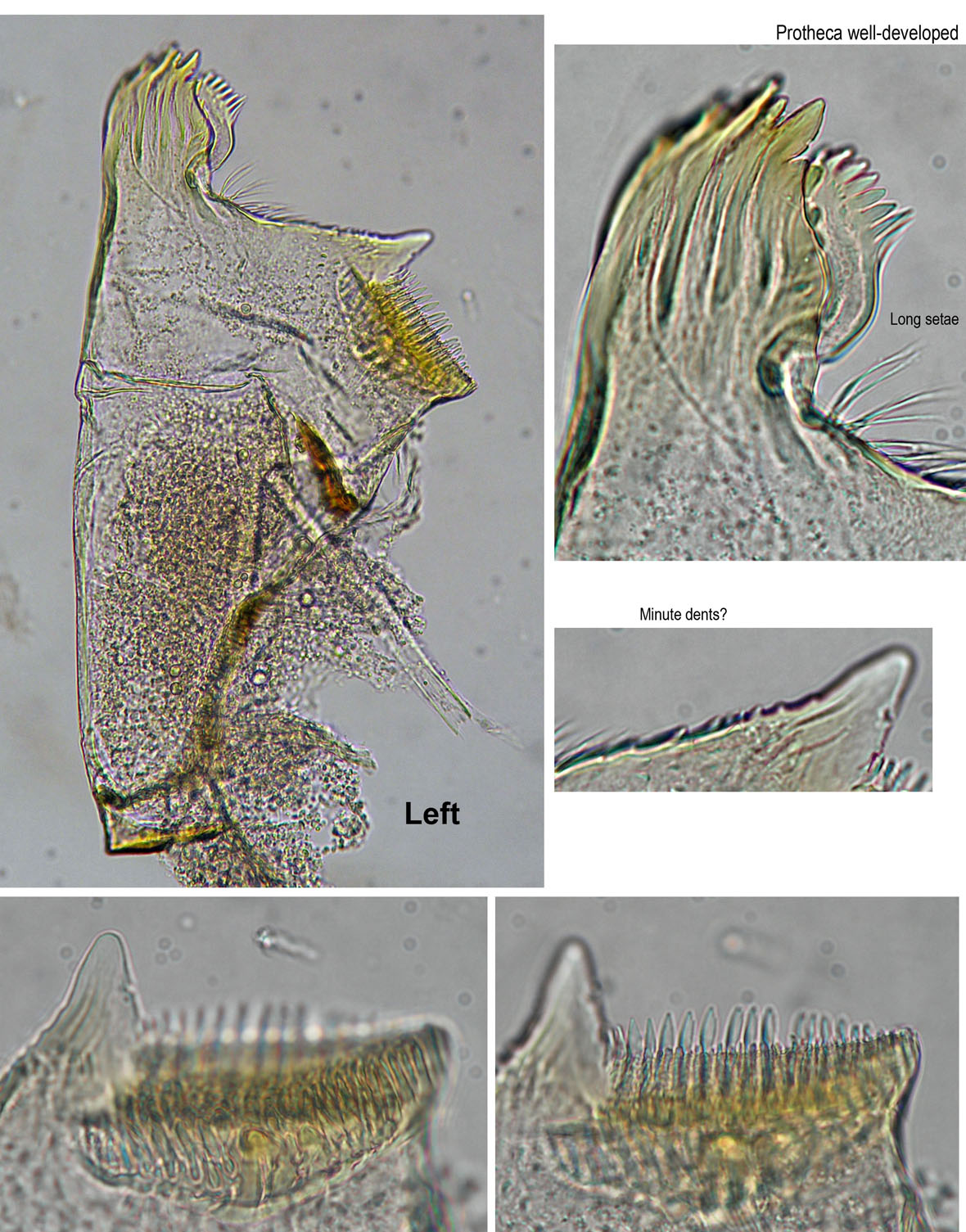 Left mandible