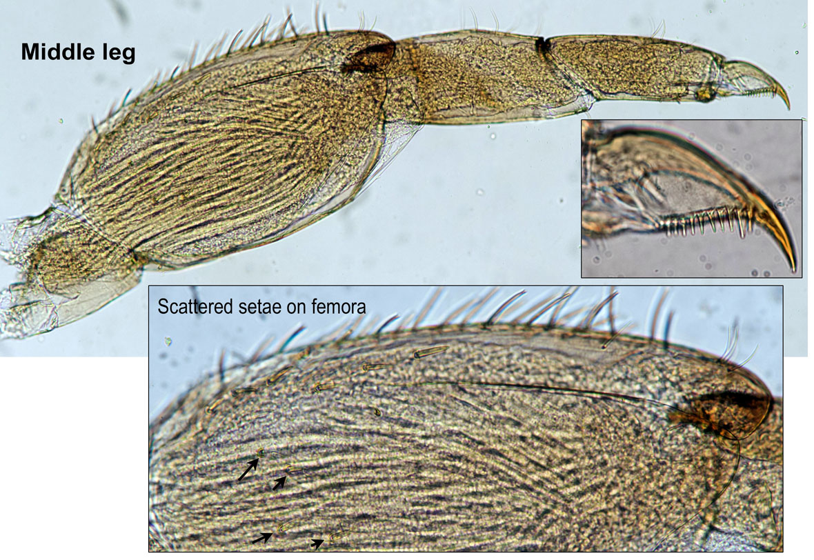 Midleg