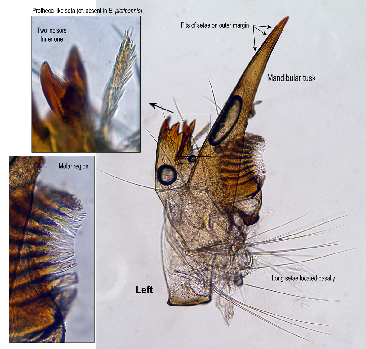 Left mandible
