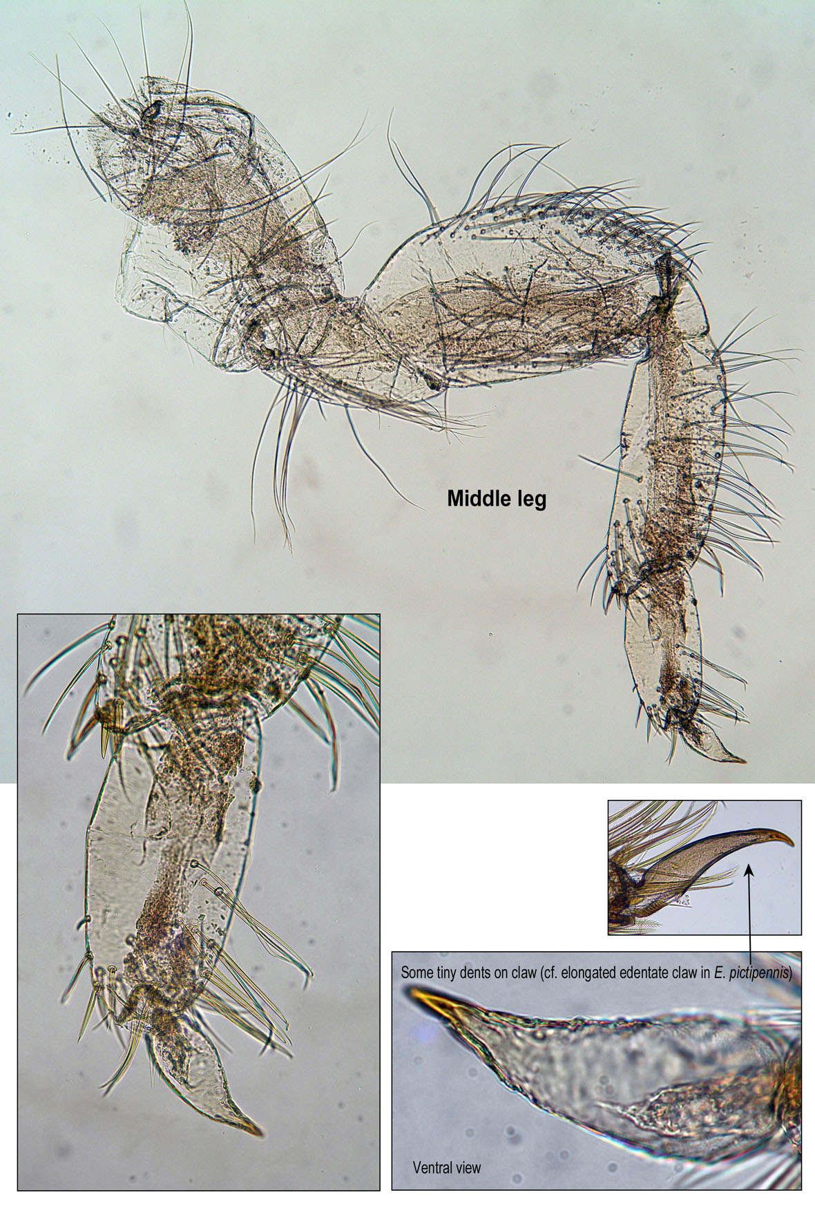 Foreleg