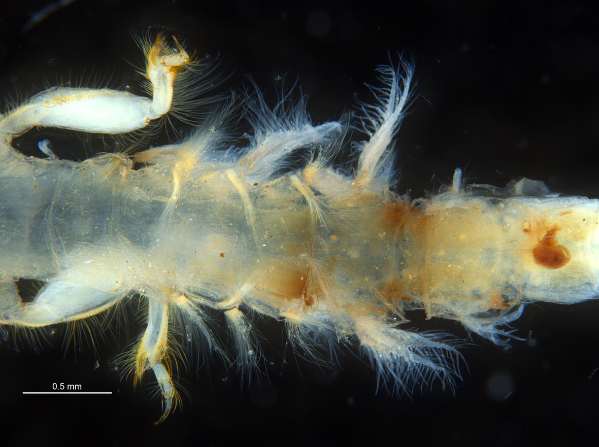 Abdomen_ventral
