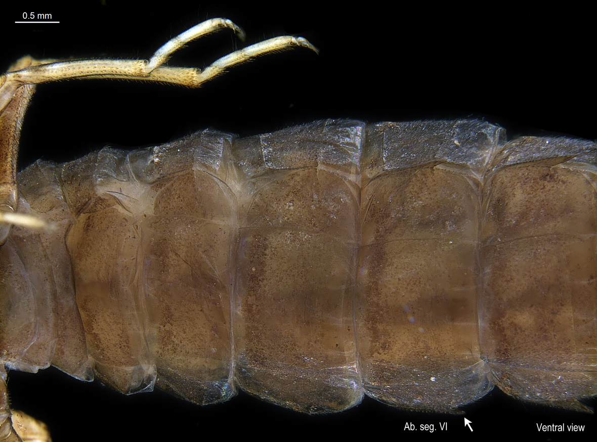 Abdomen ventral view