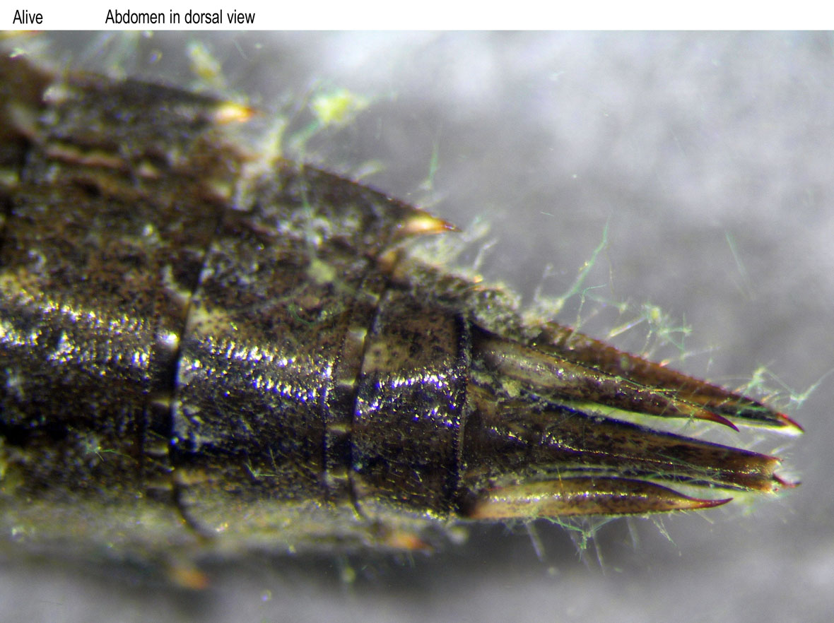 Abdomen in dorsal view