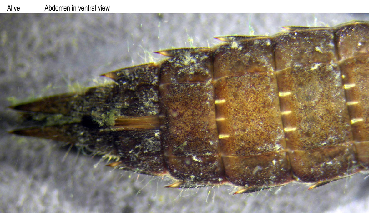 Abdomen in ventral view