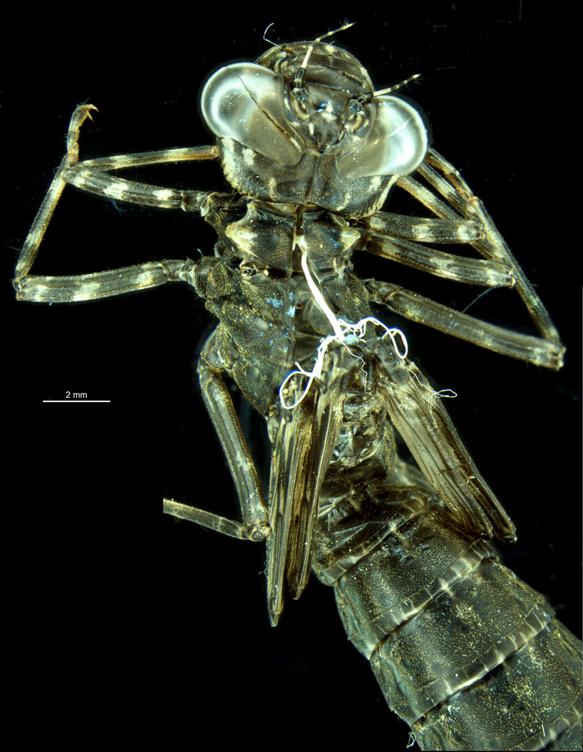 Exuvia