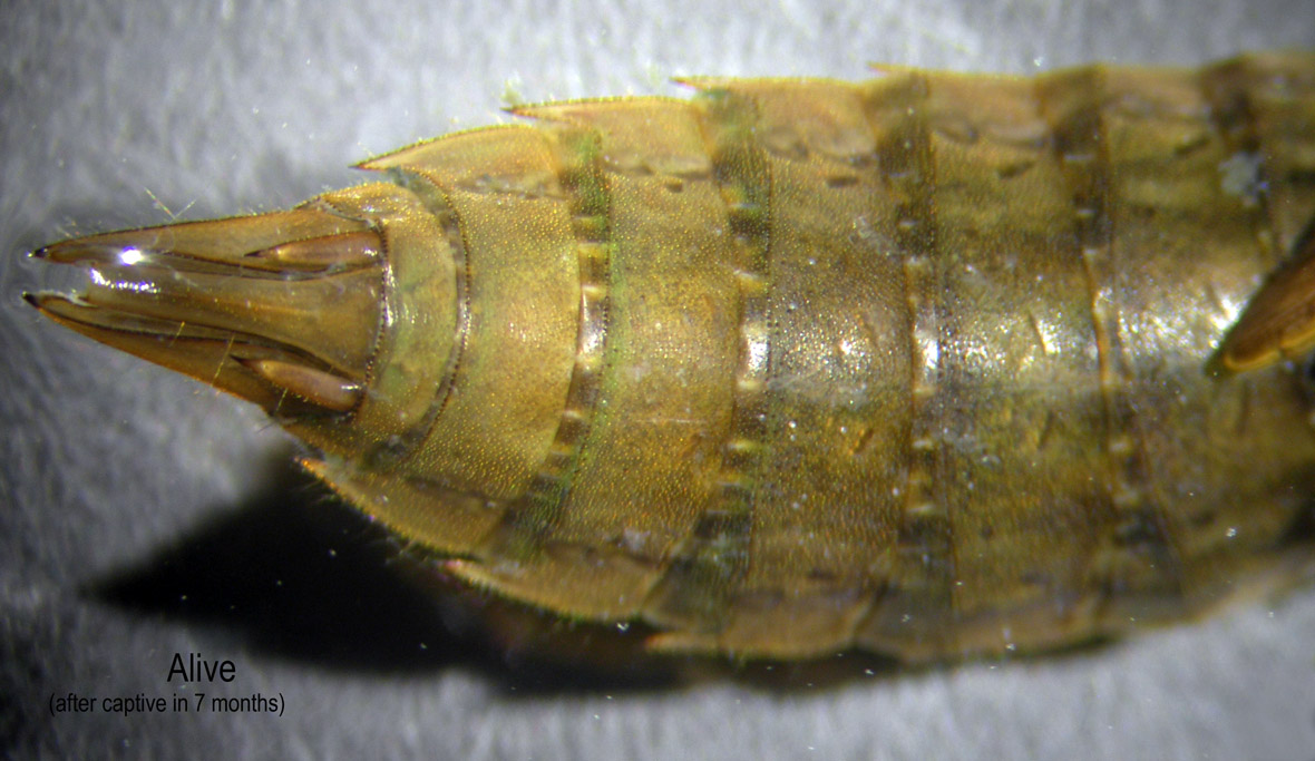 Abdomen_after7months