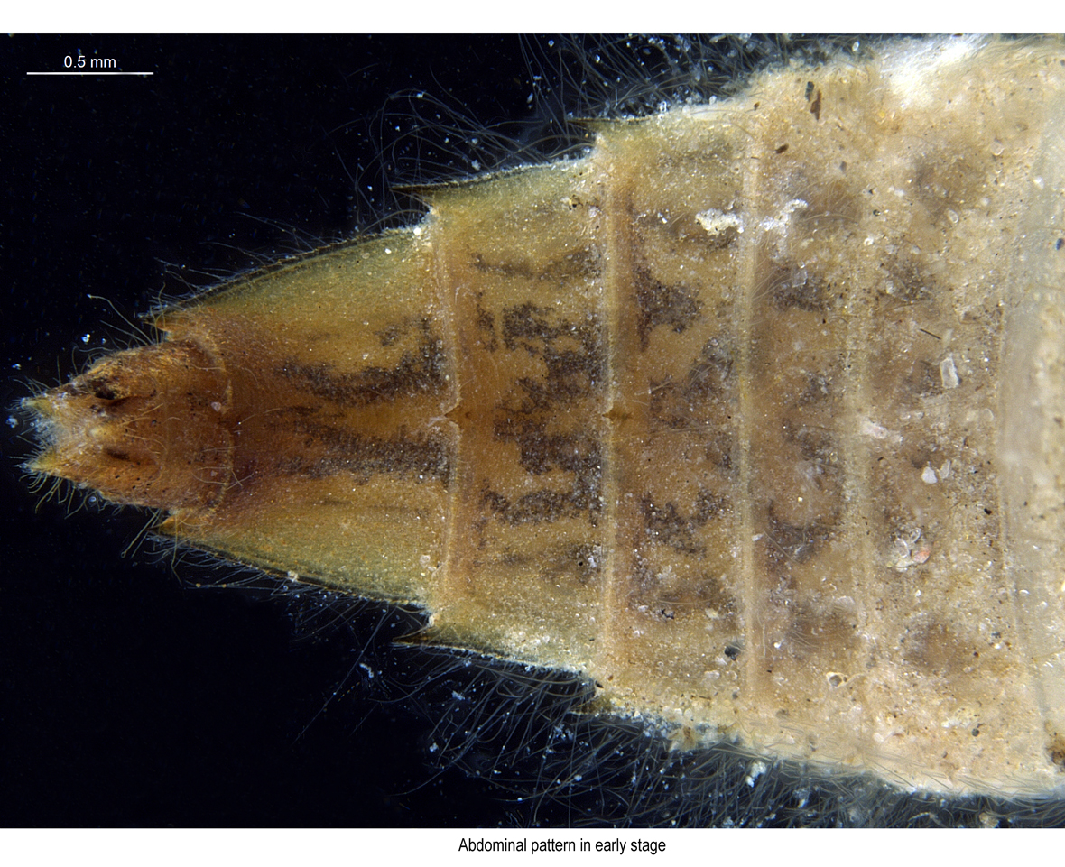 Abdomen in early stage