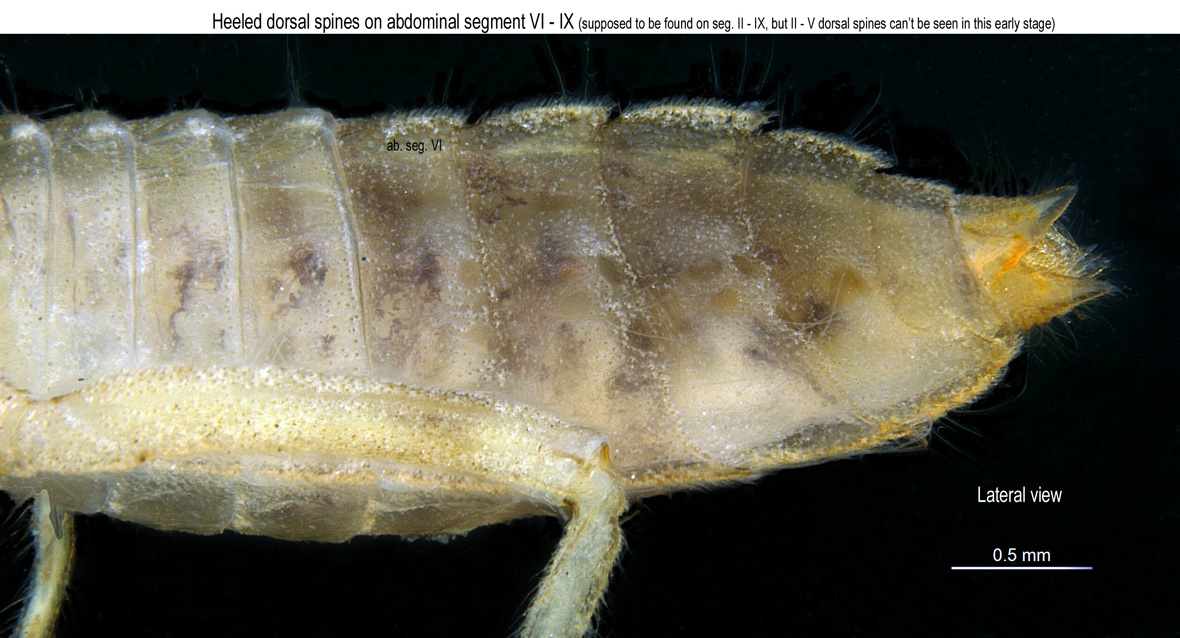 Abdomen in lateral view