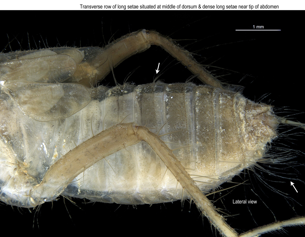 Abdomen in lateral view