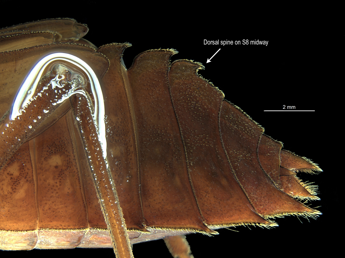 Abdomen in lateral view