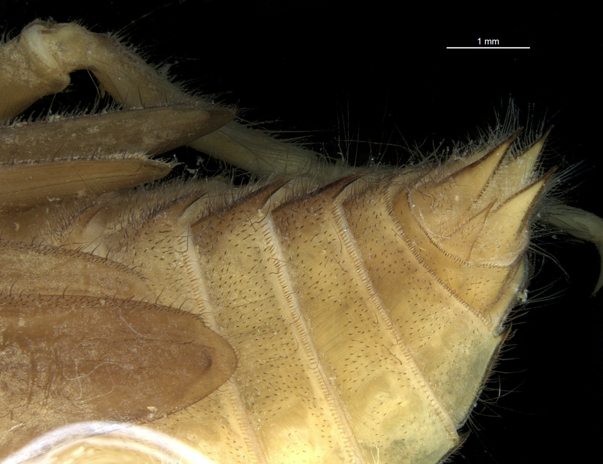 Abdomen in lateral view