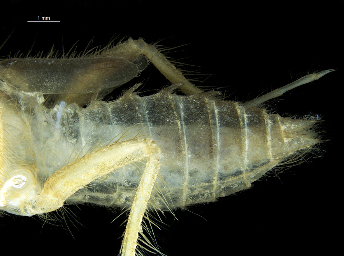 Abdomen in lateral view