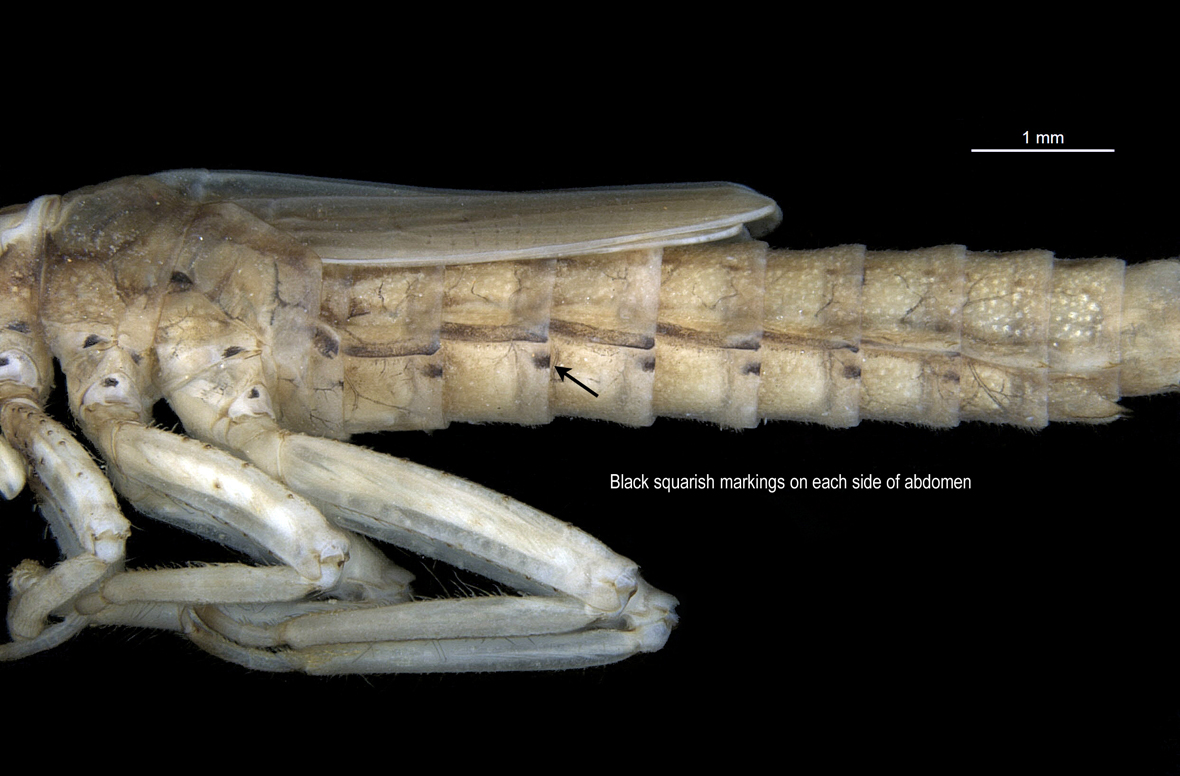 Abdomen in lateral view